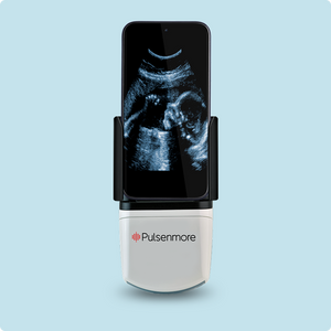 Pulsenmore home Ultrasound device with screen displaying an ultrasound image on a light blue background, featuring the brand 'Pulsenmore'.
