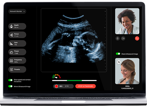 Ultrasound screen with images of an ultrasound scan and patient and doctor tele-ultrasound meeting shown  on a laptop.