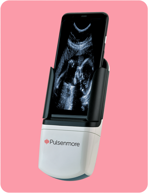  Pוulsenmore home Ultrasound device with screen displaying an ultrasound image on a pink background, featuring the brand 'Pulsenmore'.